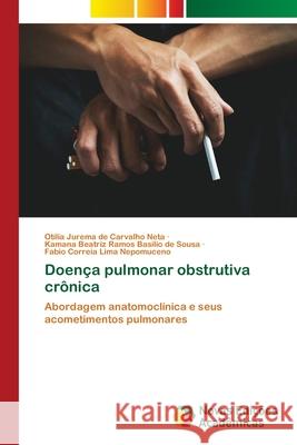 Doença pulmonar obstrutiva crônica Carvalho Neta, Otília Jurema de 9786202808705