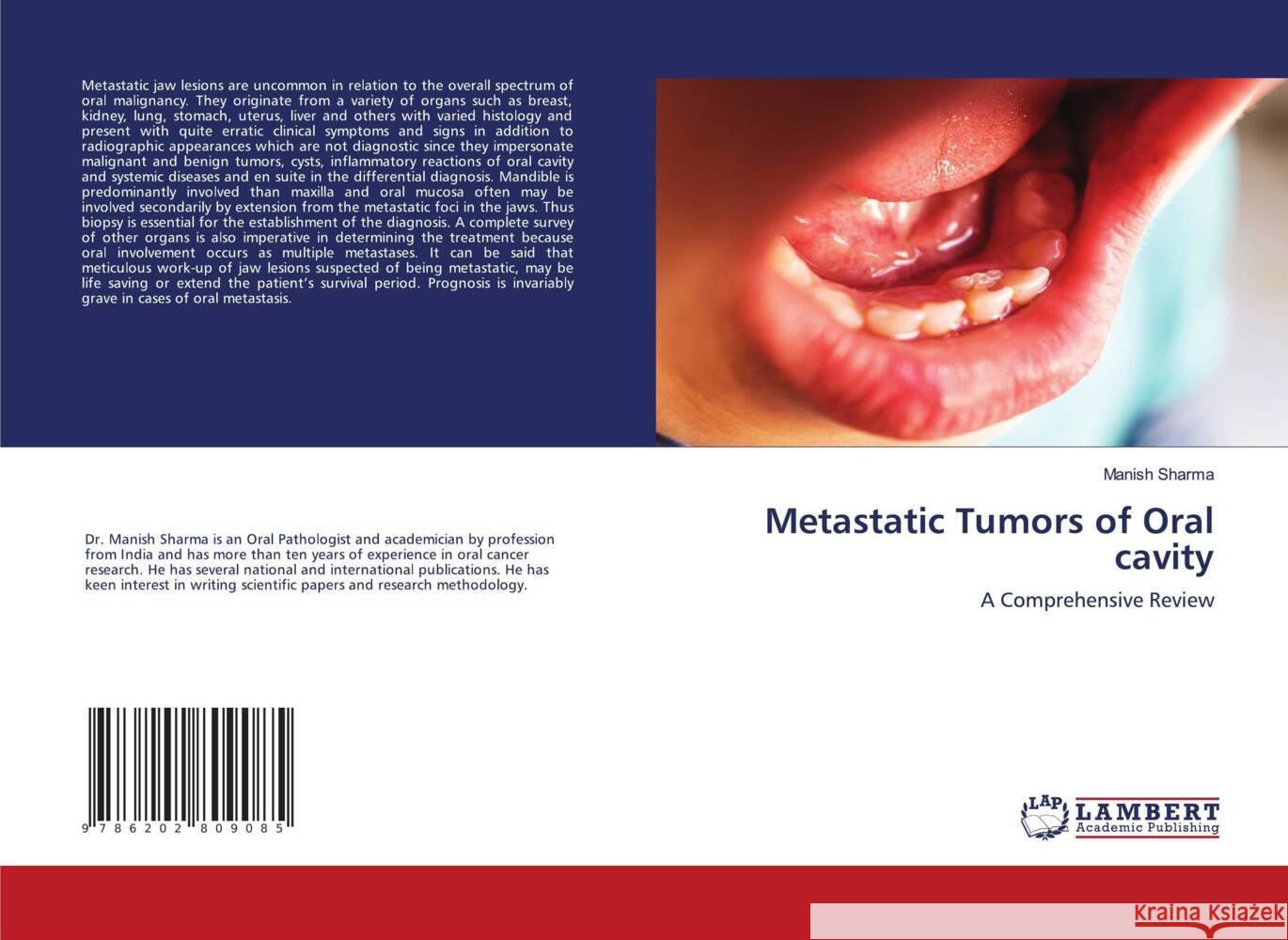 Metastatic Tumors of Oral cavity Sharma, Manish 9786202809085 LAP Lambert Academic Publishing