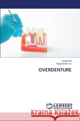 Overdenture Pal, Sneha 9786202815932 LAP Lambert Academic Publishing