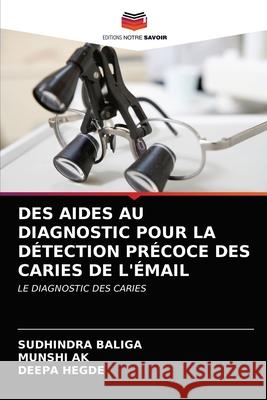 Des Aides Au Diagnostic Pour La Détection Précoce Des Caries de l'Émail Baliga, SUDHINDRA 9786202833424 Editions Notre Savoir