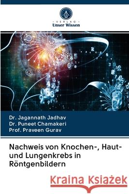 Nachweis von Knochen-, Haut- und Lungenkrebs in Röntgenbildern Jadhav, Dr. Jagannath; Chamakeri, Dr. Puneet; Gurav, Prof. Praveen 9786202834124 Verlag Unser Wissen