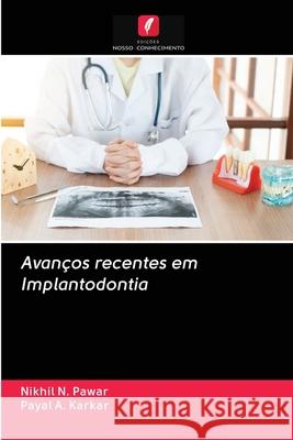 Avanços recentes em Implantodontia Pawar, Nikhil N.; Karkar, Payal A. 9786202838511 Edicoes Nosso Conhecimento