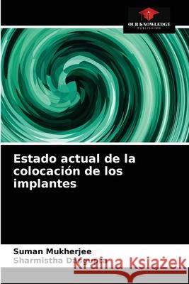 Estado actual de la colocación de los implantes Suman Mukherjee, Sharmistha Dasgupta 9786202846806