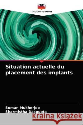 Situation actuelle du placement des implants Suman Mukherjee, Sharmistha Dasgupta 9786202846813 Editions Notre Savoir