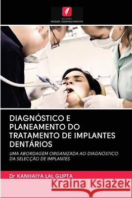 Diagnóstico E Planeamento Do Tratamento de Implantes Dentários Dr Kanhaiya Lal Gupta 9786202851893