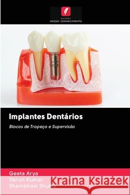 Implantes Dentários Arya, Geeta; Kumar, Varun; Shukla, Shambhavi 9786202855495 Edicoes Nosso Conhecimento