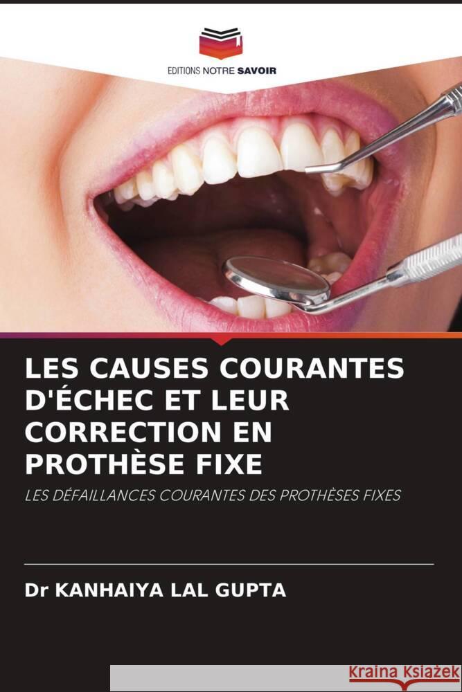 LES CAUSES COURANTES D'ÉCHEC ET LEUR CORRECTION EN PROTHÈSE FIXE LAL GUPTA, Dr KANHAIYA 9786202870559