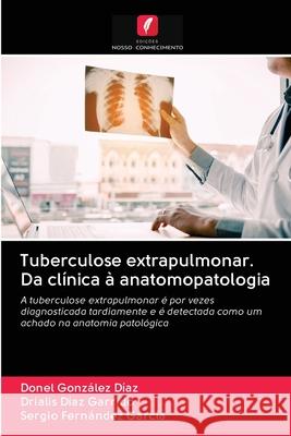 Tuberculose extrapulmonar. Da clínica à anatomopatologia González Díaz, Donel 9786202896047 Edicoes Nosso Conhecimento