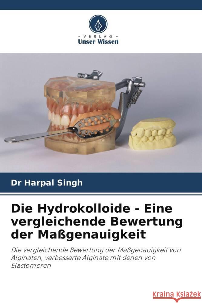 Die Hydrokolloide - Eine vergleichende Bewertung der Maßgenauigkeit Singh, Dr Harpal 9786202905404