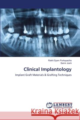 Clinical Implantology Rakhi Sya Samir Joshi 9786202917728