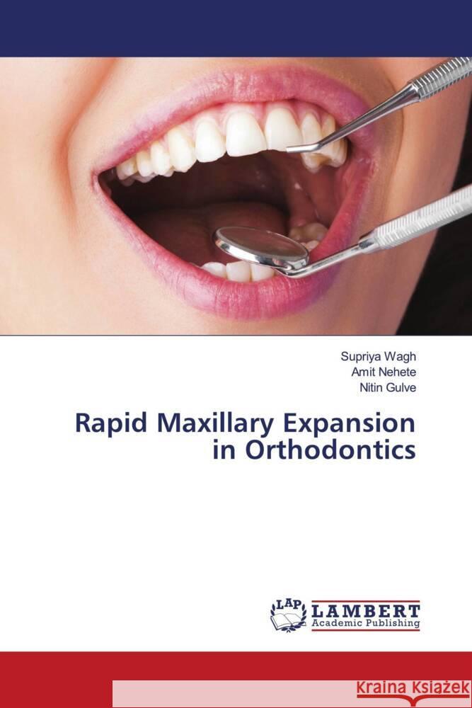 Rapid Maxillary Expansion in Orthodontics Wagh, Supriya, Nehete, Amit, Gulve, Nitin 9786202921336 LAP Lambert Academic Publishing