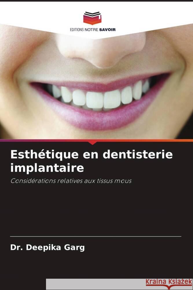 Esthétique en dentisterie implantaire Garg, Dr. Deepika 9786202939294