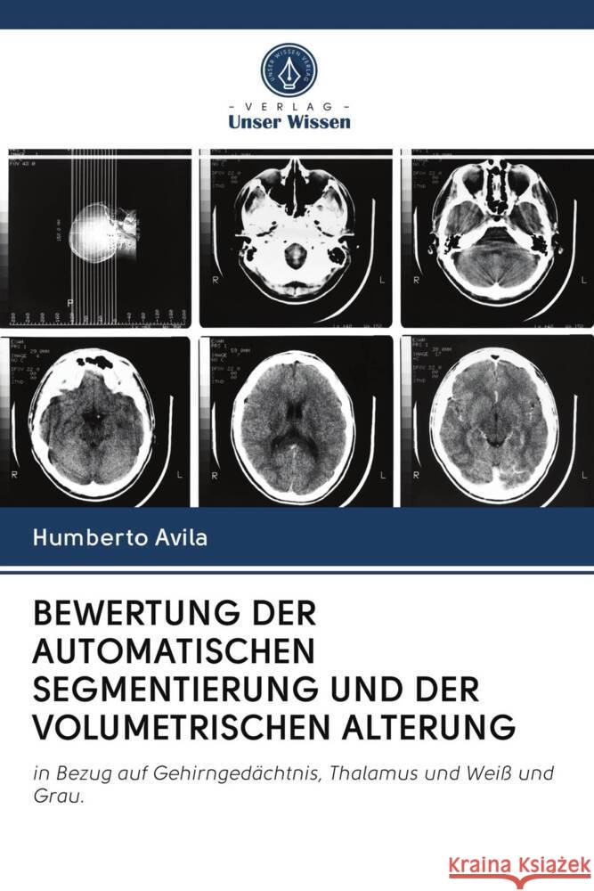 BEWERTUNG DER AUTOMATISCHEN SEGMENTIERUNG UND DER VOLUMETRISCHEN ALTERUNG Avila, Humberto 9786202944809