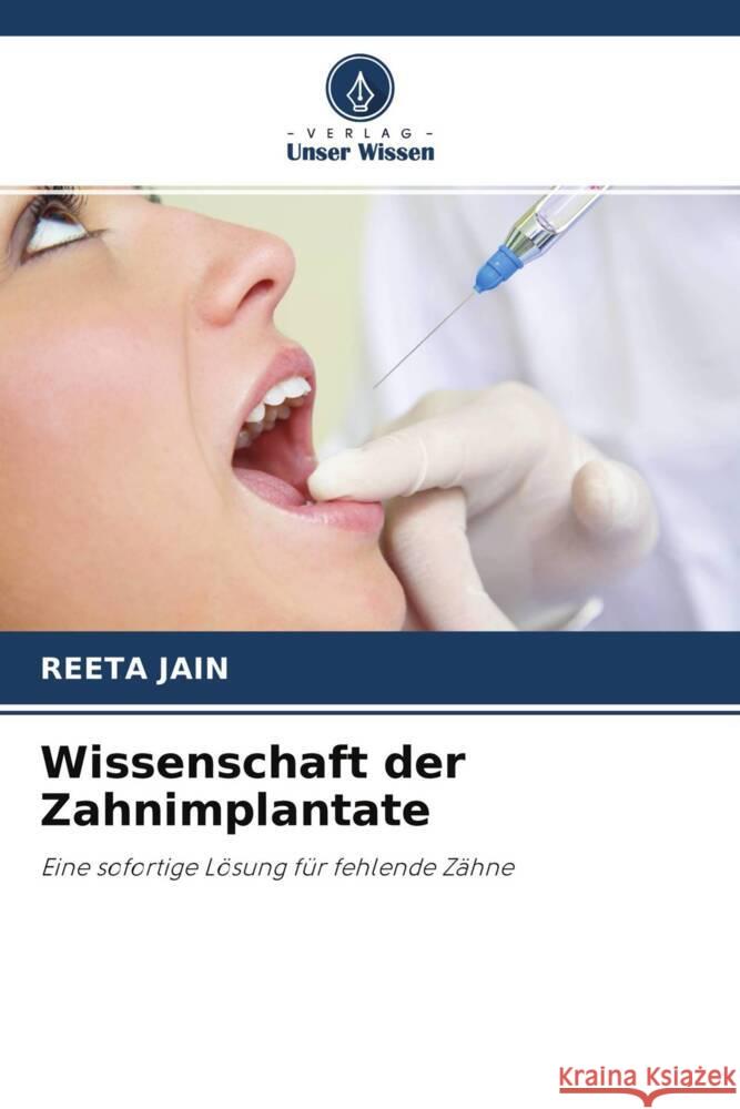 Wissenschaft der Zahnimplantate Jain, Reeta 9786202954402