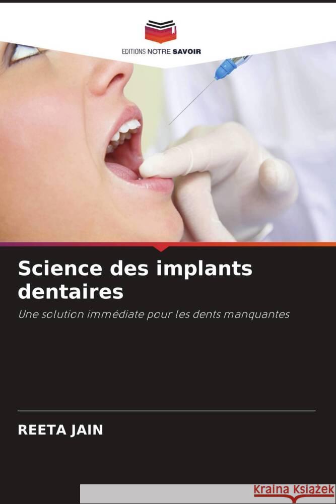 Science des implants dentaires Jain, Reeta 9786202954433