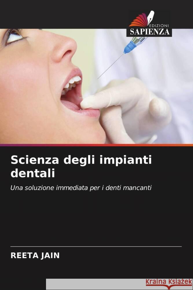 Scienza degli impianti dentali Jain, Reeta 9786202954488