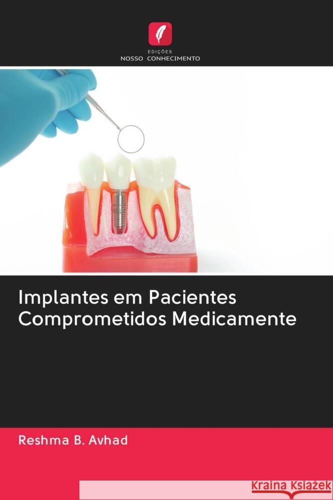 Implantes em Pacientes Comprometidos Medicamente Avhad, Reshma B. 9786202963299