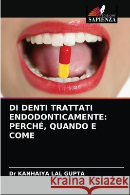 Di Denti Trattati Endodonticamente: Perché, Quando E Come Dr Kanhaiya Lal Gupta 9786202976510