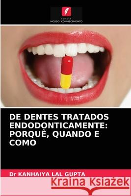 de Dentes Tratados Endodonticamente: Porquê, Quando E Como Dr Kanhaiya Lal Gupta 9786202976527 Edicoes Nosso Conhecimento