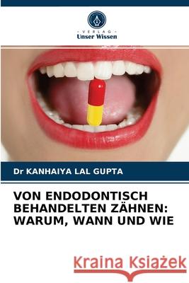 Von Endodontisch Behandelten Zähnen: Warum, Wann Und Wie Dr Kanhaiya Lal Gupta 9786202976558