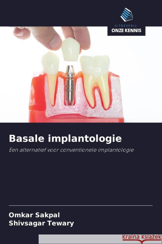 Basale implantologie Sakpal, Omkar, Tewary, Shivsagar 9786202981743 Uitgeverij Onze Kennis