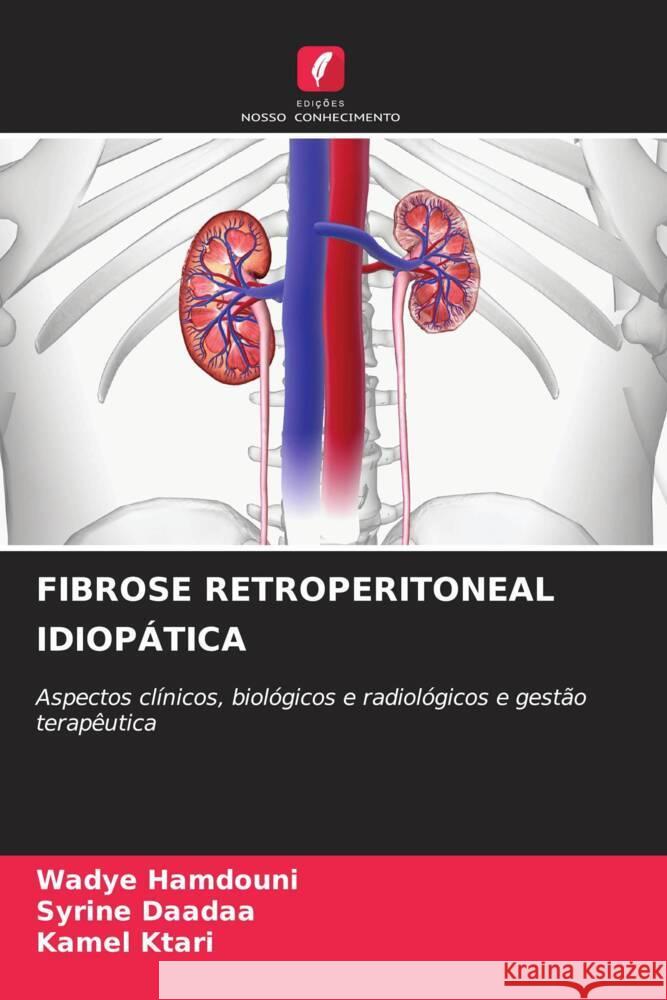 FIBROSE RETROPERITONEAL IDIOPÁTICA HAMDOUNI, WADYE, Daadaa, Syrine, Ktari, Kamel 9786203002270
