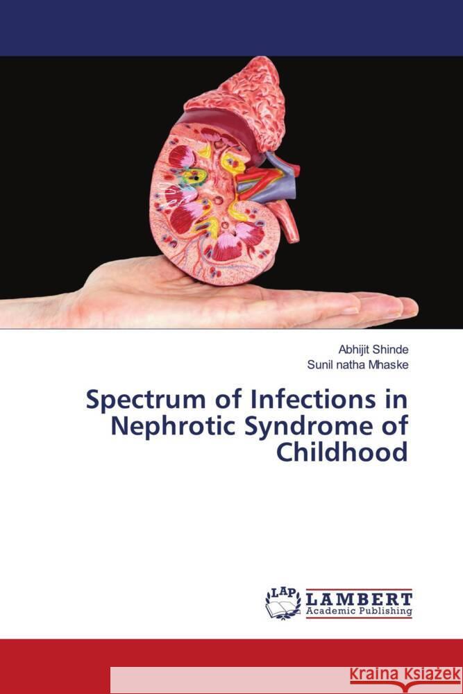 Spectrum of Infections in Nephrotic Syndrome of Childhood SHINDE, ABHIJIT, MHASKE, SUNIL NATHA 9786203024586