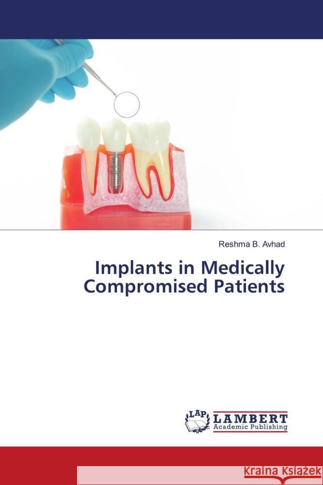 Implants in Medically Compromised Patients Avhad, Reshma B. 9786203026917