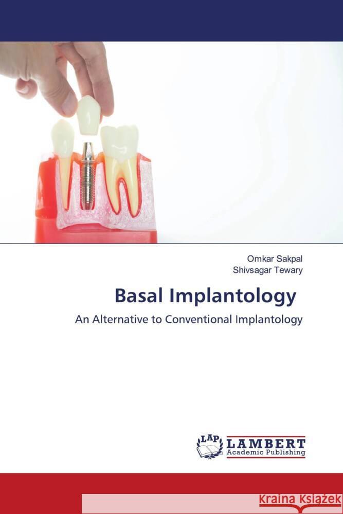 Basal Implantology Sakpal, Omkar, Tewary, Shivsagar 9786203027877 LAP Lambert Academic Publishing