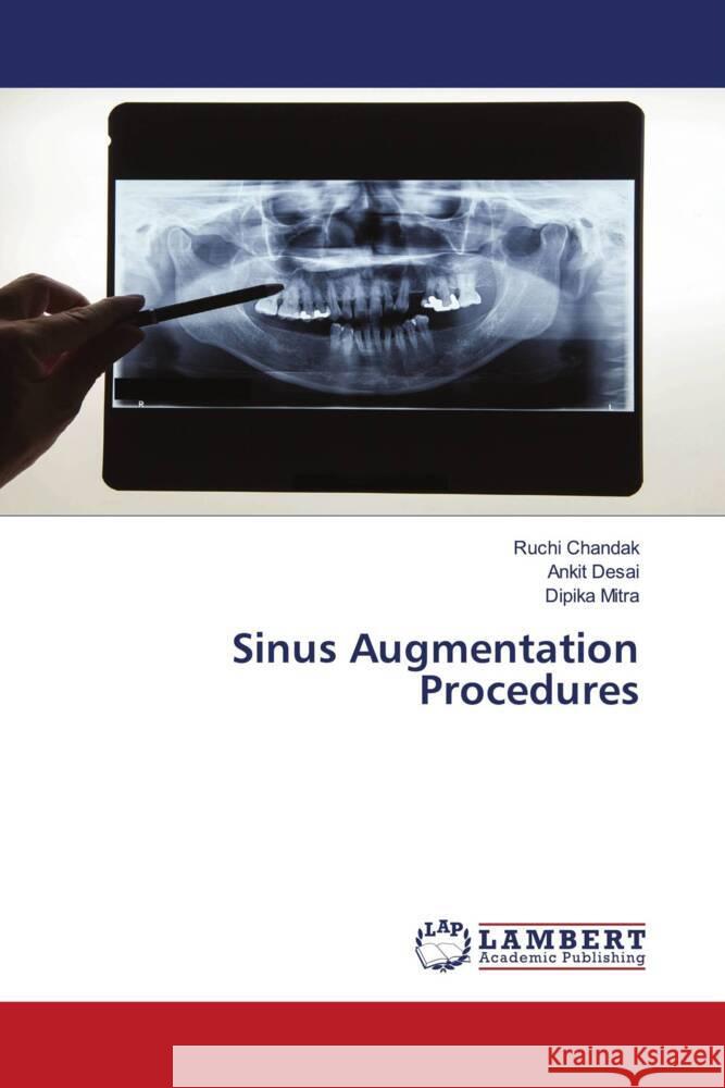 Sinus Augmentation Procedures Chandak, Ruchi, Desai, Ankit, Mitra, Dipika 9786203028492