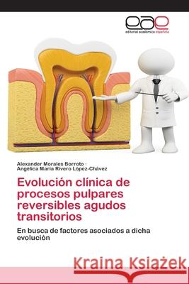 Evolución clínica de procesos pulpares reversibles agudos transitorios Alexander Morales Borroto, Angélica María Rivero López-Chávez 9786203030204