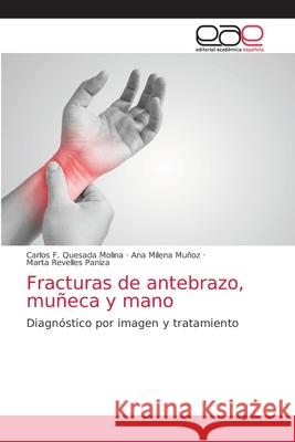 Fracturas de antebrazo, muñeca y mano Quesada Molina, Carlos F. 9786203036183