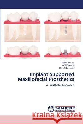 Implant Supported Maxillofacial Prosthetics Manoj Kumar Aditi Saxena Rahul Katyayan 9786203042634