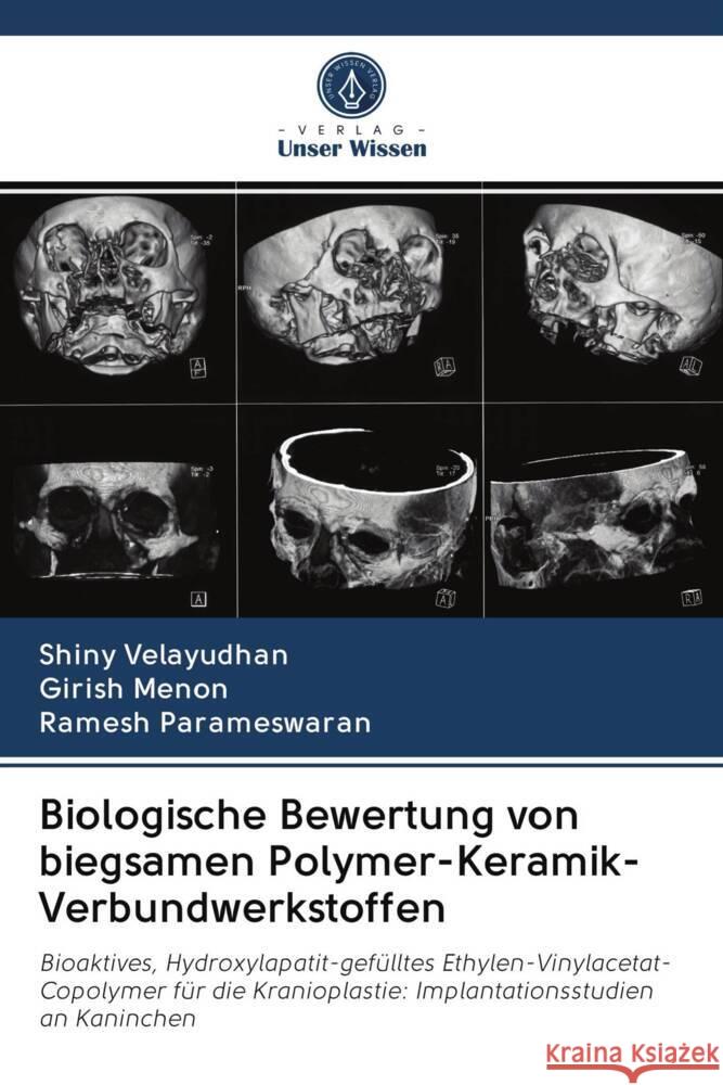 Biologische Bewertung von biegsamen Polymer-Keramik-Verbundwerkstoffen Velayudhan, Shiny, Menon, Girish, Parameswaran, Ramesh 9786203044485