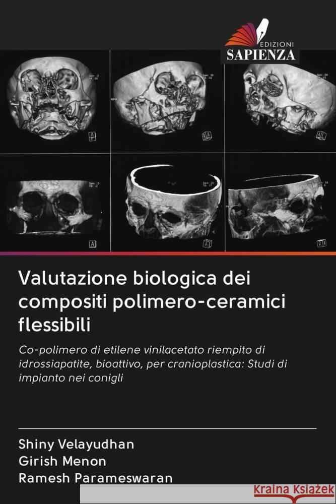 Valutazione biologica dei compositi polimero-ceramici flessibili Velayudhan, Shiny, Menon, Girish, Parameswaran, Ramesh 9786203044508