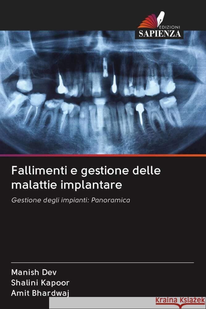 Fallimenti e gestione delle malattie implantare Dev, Manish, Kapoor, Shalini, Bhardwaj, Amit 9786203050714