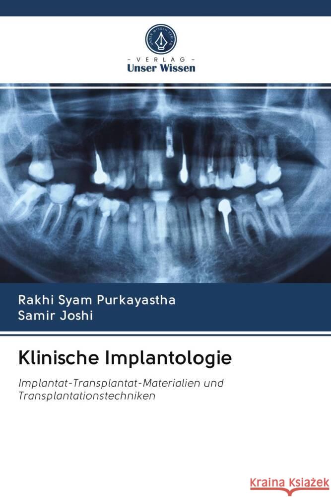 Klinische Implantologie Syam Purkayastha, Rakhi, Joshi, Samir 9786203060331