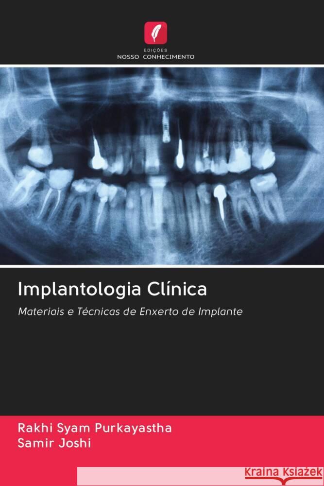 Implantologia Clínica Syam Purkayastha, Rakhi, Joshi, Samir 9786203060706