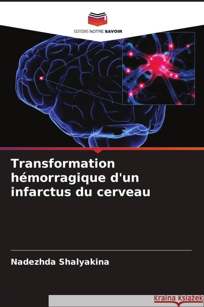 Transformation hémorragique d'un infarctus du cerveau Shalyakina, Nadezhda 9786203063004