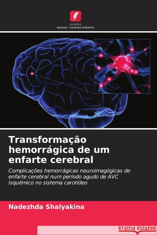 Transformação hemorrágica de um enfarte cerebral Shalyakina, Nadezhda 9786203063042