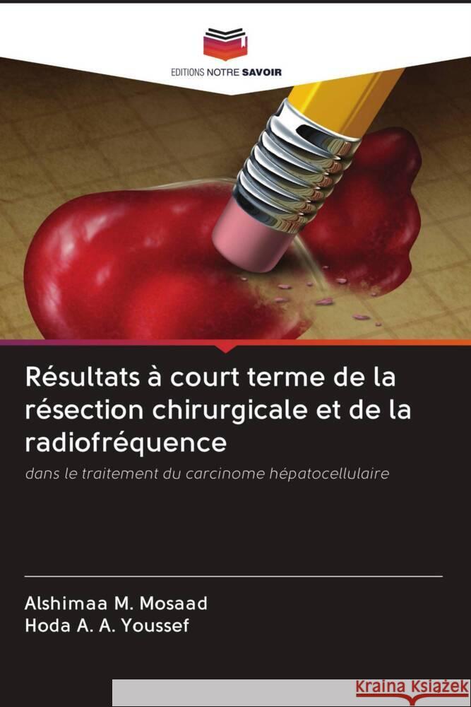 Résultats à court terme de la résection chirurgicale et de la radiofréquence M. Mosaad, Alshimaa, A. A. Youssef, Hoda 9786203089004