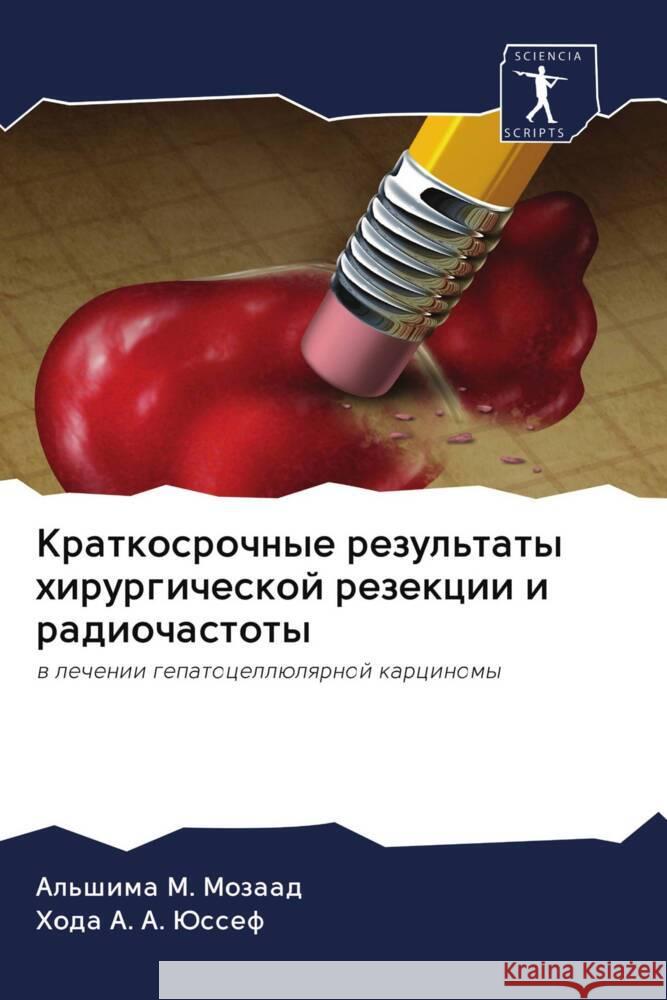 Kratkosrochnye rezul'taty hirurgicheskoj rezekcii i radiochastoty M. Mozaad, Al'shima, A. A. Jussef, Hoda 9786203089134 Sciencia Scripts