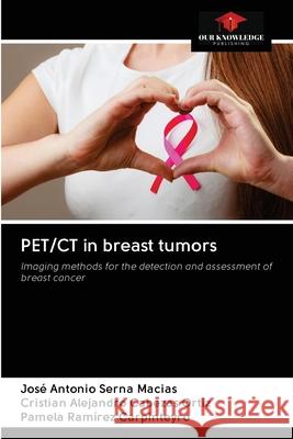 PET/CT in breast tumors José Antonio Serna Macias, Cristian Alejandro Cabezas Ortiz, Pamela Ramírez Carpinteyro 9786203113877 Our Knowledge Publishing