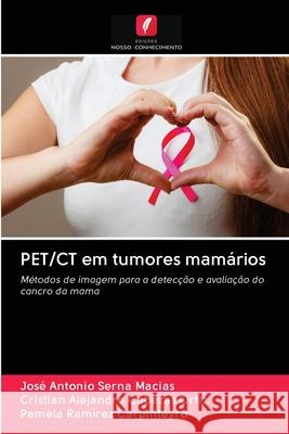 PET/CT em tumores mamários José Antonio Serna Macias, Cristian Alejandro Cabezas Ortiz, Pamela Ramírez Carpinteyro 9786203113921 Edicoes Nosso Conhecimento