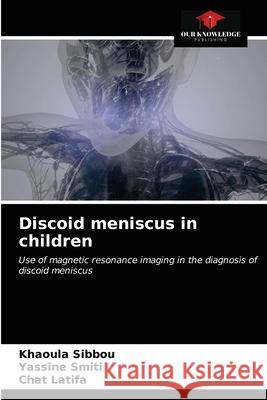 Discoid meniscus in children Khaoula Sibbou Yassine Smiti Chat Latifa 9786203127560