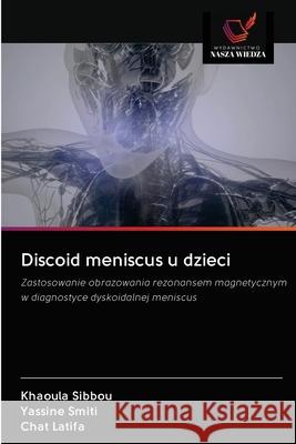 Discoid meniscus u dzieci Khaoula Sibbou Yassine Smiti Chat Latifa 9786203127607