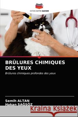 Brûlures Chimiques Des Yeux Altan, Semih 9786203156461