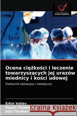 Ocena ciężkości i leczenie towarzyszących jej urazów miednicy i kości udowej Erkin Valiev, Hasan Tilyakov, Aziz Tilyakov 9786203176414 Wydawnictwo Nasza Wiedza