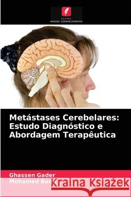 Metástases Cerebelares: Estudo Diagnóstico e Abordagem Terapêutica Ghassen Gader, Mohamed Badri 9786203183672 Edicoes Nosso Conhecimento