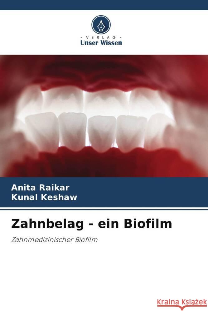 Zahnbelag - ein Biofilm Raikar, Anita, Keshaw, Kunal 9786203195811